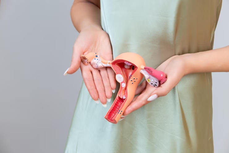 Gynecologic Surgeries